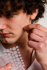 man is applying acne pimple patch on his face to heal from zits. dermatological stickers to absorb e