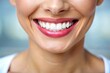© Caitlin - A warm and radiant close-up of a woman's bright, healthy smile with perfectly aligned teeth, against a blurred square background, highlighting dental beauty.