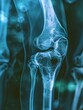 © K silver - X-ray of human knee joint, detailed bone structure, medical imaging perspective