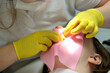 © Oleksandra - Dentist filling. female dentist examining young girl patient's teeth at dental clinic. Doctor probing teeth with dental instrument using an explorer look for cavities treatment and checking