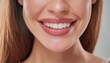 © Marko - Dental care, beautiful smile of healthy woman, white teeth coloseup