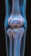 © BoOm - Detailed X-ray image of a human knee joint showing bones and cartilage, ideal for medical and educational purposes.