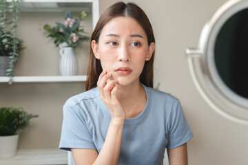 Sensitive skin with cosmetology, Asian young woman looking at red spot on her face from cosmetic allergy in the mirror.