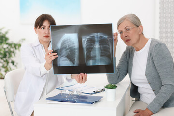 Wall Mural - Lung disease. Doctor showing chest x-ray to her patient at table in clinic