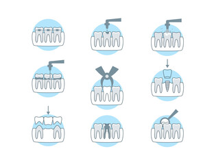 Poster - dental procedure clinic sign color thin line icon set include of implant and orthodontics . vector i