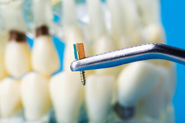 A dental metal pin in tweezers against the background of a medical model of a dental jaw. The concept of installing a dental crown on a post in orthodontics, macro.