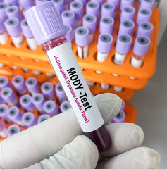 Sticker - Blood sample for MODY or Maturity-Onset Diabetes of the Young test to diagnose neonatal diabetes (ND) in a symptomatic individual.