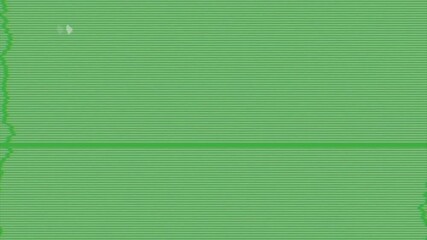 Wall Mural - animation video loop line error and glitch noise on green screen background , good for video error t