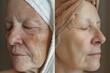 © SHOTPRIME STUDIO - Transformation of facial skin condition in middleaged woman before and after cosmetic and beauty regimen treatment