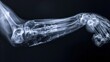 © Jafree - Intricate X-Ray Image of a Human Elbow Joint Highlighting Bone Structure and Details. Concept of Human Anatomy, Medical Analysis, Skeletal Study, Orthopedic Examination