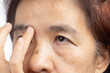 © toa555 - Senior asian woman worry about eye bags and dark spot.