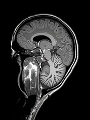 Wall Mural - A sagittal MRI scan of the human brain. AI.