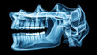 © Sergey - X-ray view of a human skull showing detailed dental structure including upper and lower jaw with teeth, and parts of the skull and vertebral column.