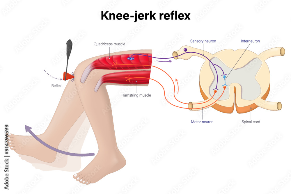 The knee-jerk reflex vector. Reflex action of the leg involves an involuntary response. Sensory neuron, motor neuron and interneuron.