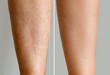 © Praewphan - Image before and after woman's Legs hairs removal, skin care treatment for smooth skin concept.