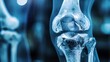 © LuvTK - Close-up X-ray of knee joints focusing on arthritis and cartilage wear, high clarity and detail, blue-gray monochrome, clean medical imaging, examination room setting, crisp bone details.