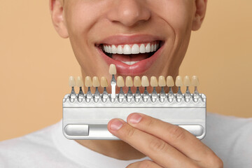 Canvas Print - Happy young man with teeth color samples on beige background, closeup. Dental veneers