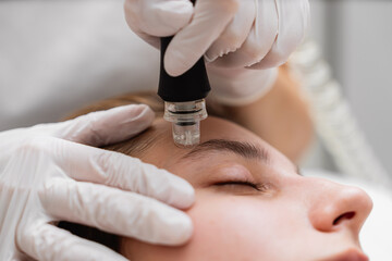 Microdermabrasion treatment session at a skincare clinic for facial rejuvenation