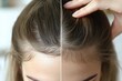 © KADER - Close-Up of Woman's Thinning Hairline Before and After Treatment – High-Resolution Detail