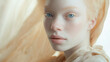© Kanchanit - Elegant Albino Woman in Beige Silk Dress with Light Blue Eyes and Soft Background, Close-Up Photography