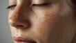 © Darya - This close-up showcases melasma on facial skin, highlighting variations in skin tone and texture with soft natural light