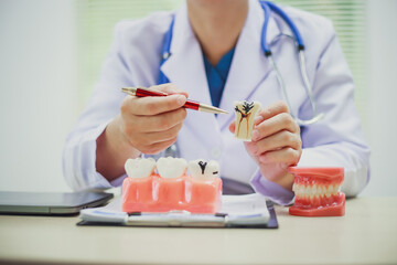 Dentures, dentures in the jaw, root canal treatment, gum disease, tooth models for dentists who are studying dentistry.