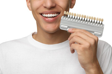 Canvas Print - Happy young man with teeth color samples on white background, closeup. Dental veneers