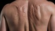 © Юлия Жигирь - Rashes on a man's back