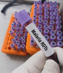 Canvas Print - Blood test sample for mRDT or malaria rapid diagnostic test. Histidine Rich protein II (HRP2) test, to diagnose Plasmodium falciparum. Malaria parasite.