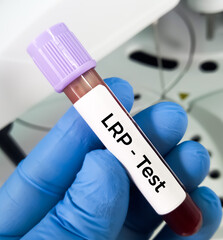 Wall Mural - Blood sample for Lung Resistance Protein (LRP) test, to diagnose Chronic myeloid leukemia (CML).