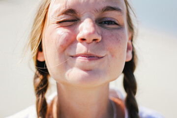 Playful close-up of a young woman with braids, making a funny face while squinting under the bright sun.