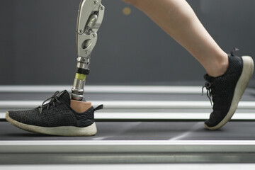 prosthetic, artificial leg. woman with prosthetic leg using walking on treadmill while working out i