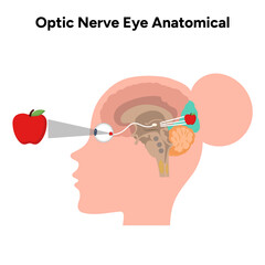 Canvas Print - Optic nerve eye anatomical. Medical illustration