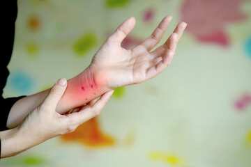 person holding a red and swollen wrist with scratches, depicting pain and injury on a colorful backg