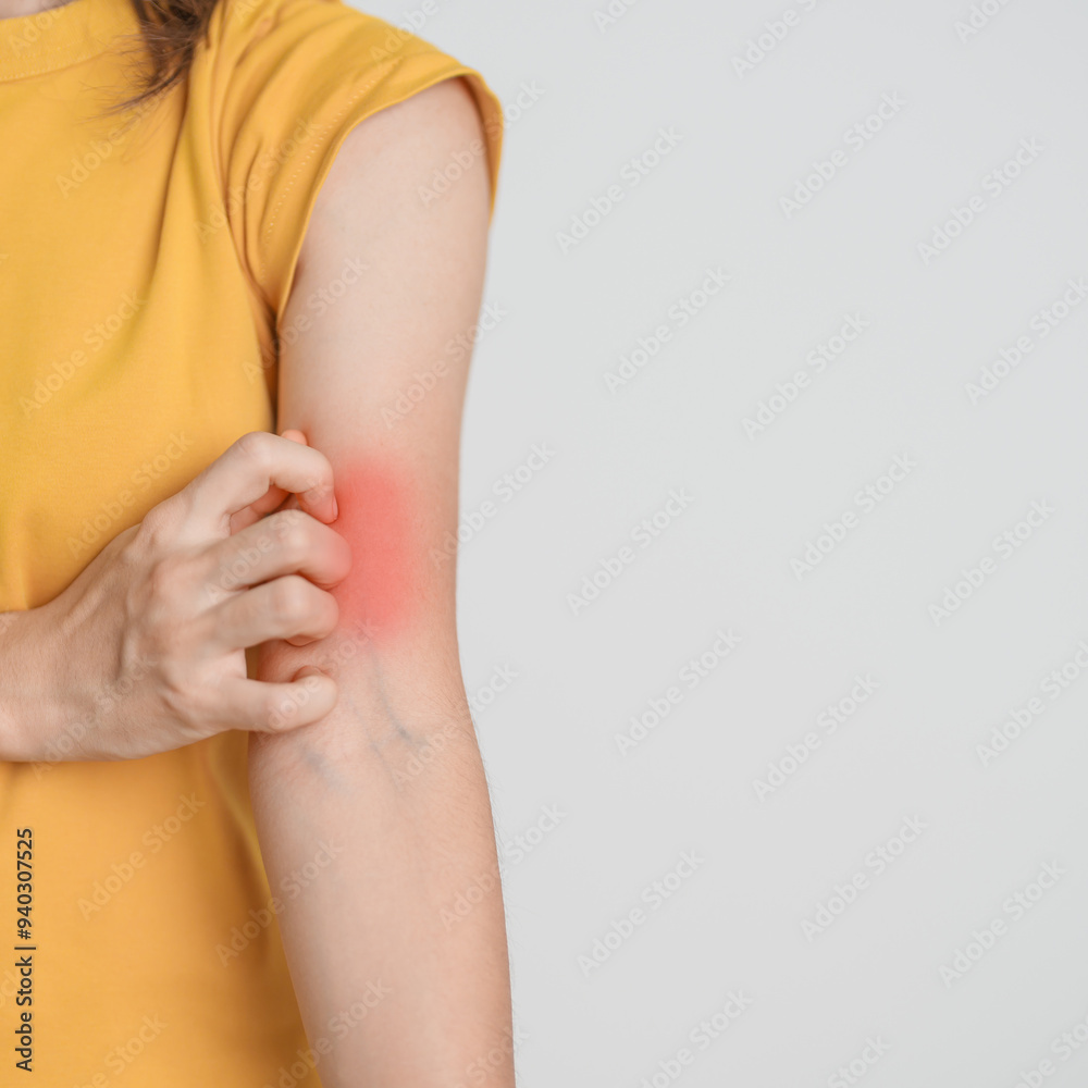 woman itching and scratching itchy arm. Sensitive Skin Allergic ...