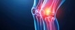 © Soulstarry  - 3D rendered illustration of a human knee joint with inflammation or injury highlighted in a bright red color, on a blue background.