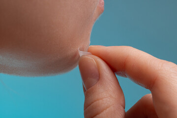 girl with acne stick round acne patch on her cheek. using acne patches for treatment of pimple and r