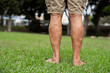 © sutulastock - Elderly Man's Bare Legs with Varicose Veins in a Park, Standing on Green Grass