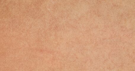 Close-Up of Human Skin Texture