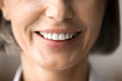 © fizkes - Close up of beautiful older woman smile after whitening procedure, demonstrate healthy teeth, feel satisfied visiting dental clinic, oral treatment, enamel cleaning. Health, restoration, dentalcare