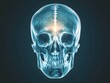 © Chayada - Human skull X-ray with a highlighted fracture line causing pain, highly detailed medical illustration