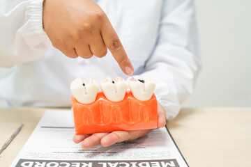  A female doctor sits at a table in a hospital, discussing dental issues like wisdom teeth, cavities, dentures,missing teeth, and cracked teeth, explaining the causes and treatment of dental caries.