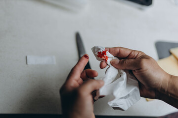 Man cut finger while cooking in kitchen, closeup