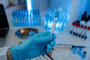 Wall Mural - a researcher is conducting scientific experiments on a liquid substance, a scientist is using labora