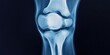 © kwanchaift - Advanced medical technology using X-ray imagery of a knee joint to assist in orthopedic diagnostics and treatment.