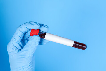 Wall Mural - Laboratory worker holding test tube with blood sample and blank label on light blue background, closeup. Medical analysis