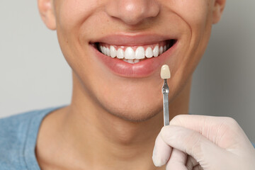 Canvas Print - Doctor checking young man's teeth color on gray background, closeup. Dental veneers