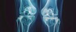 © Ai Studio - An x-ray image showing a detailed view of two healthy knee joints, highlighting the bones and joint structures in a monochromatic blue hue.