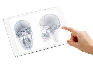 Poster - The tablet reveals high-resolution  detailed Skull X-ray image AP and Lateral view isolated on white background. Clipping path.