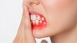 © BOJOShop - Close Up of Woman s Gums with Gingivitis